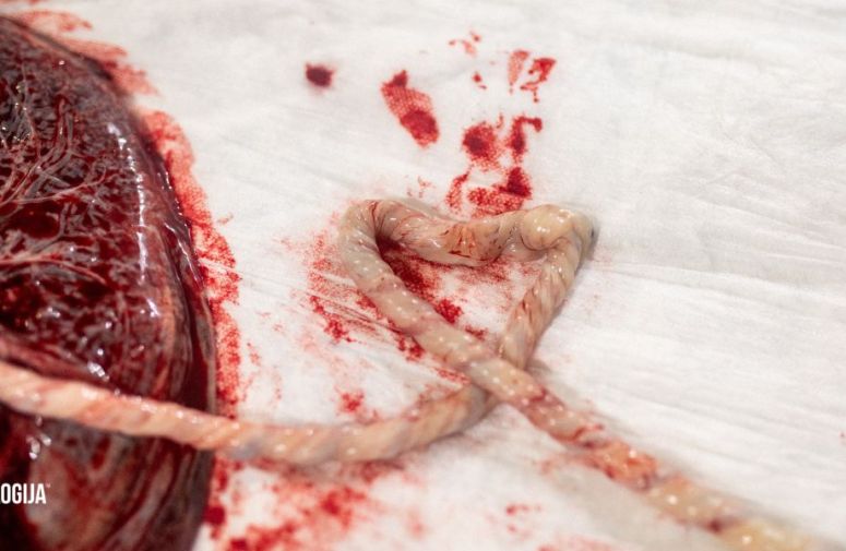 Zanimljivosti o trudnoći- šta je placenta i koja je njena uloga?