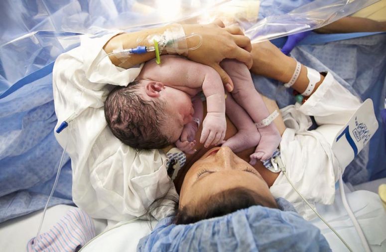 Izbor anestezije - Rađanje deteta je nezaboravan doživljaj