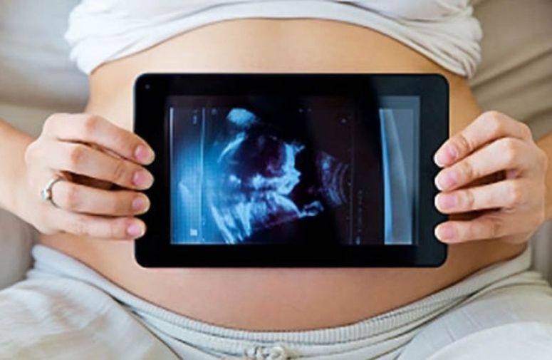 Minimalno tri ultrazvučna pregleda u trudnoći