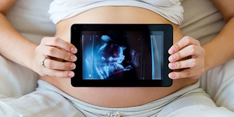 Minimalno tri ultrazvučna pregleda u trudnoći